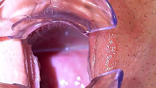 Cute Teen Vanessa Secret Gets Her Pussy Examined