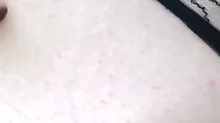 I Need Some Atention Baby&;