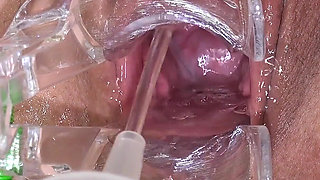 Big Mature Pussy and Cervix Examined with Speculum