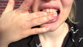Finger & Hand Biting Deep Marks & Licking